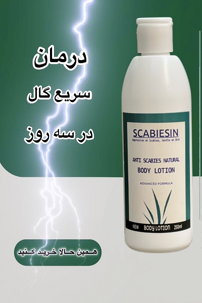 اسکیبین لوسیون گیاهی ضد گال