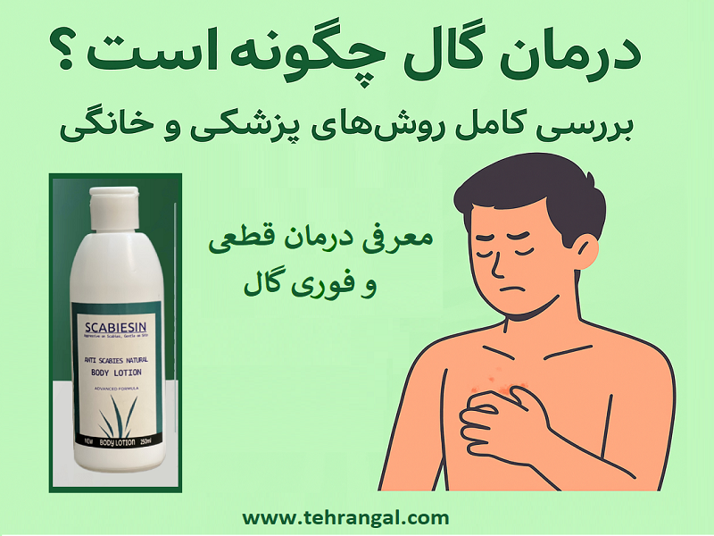 درمان گال | روشهای پزشکی و خانگی