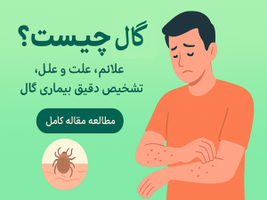 گال چیست؟