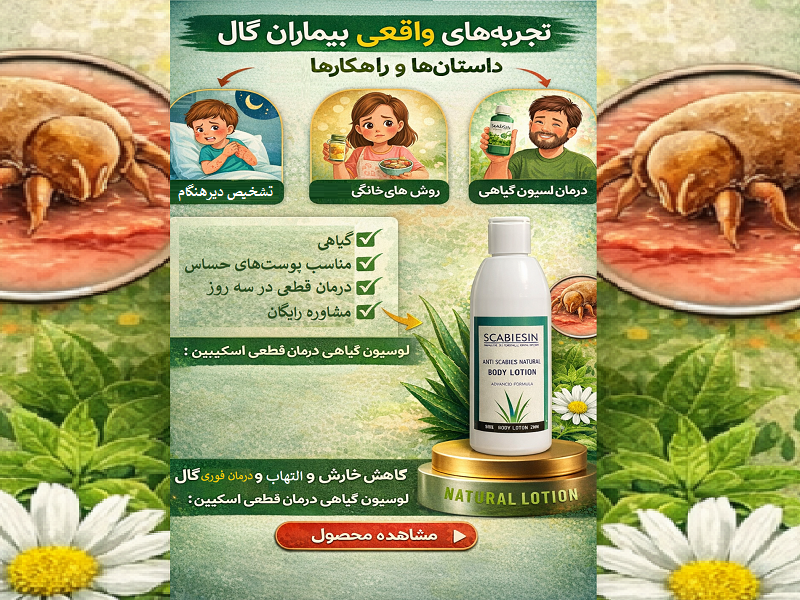 تجربههای واقعی بیماران گال داستانها و راهکارهای موثر درمان