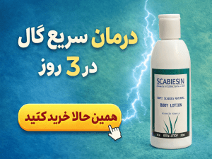 علایم گال