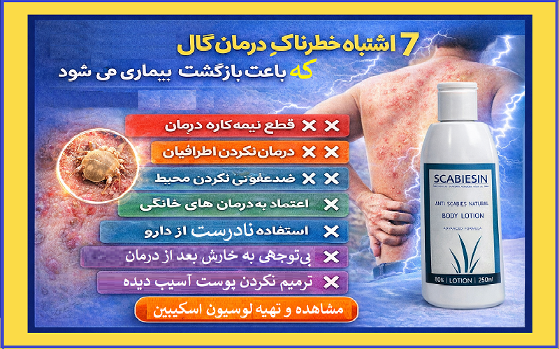 اشتباه خطرناک در درمان گال