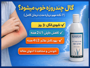 گال چند روزه خوب می‌شود؟
