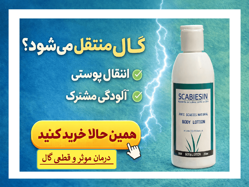 گال چگونه منتقل می‌شود؟